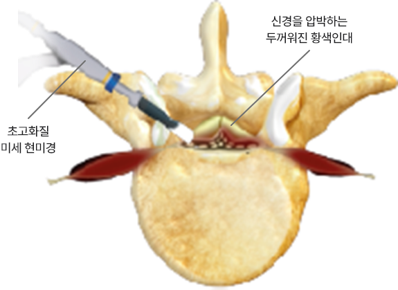 척추단면